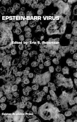 Epstein-Barr Virus - cover