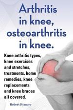 Arthritis in knee, osteoarthritis in knee. Knee arthritis types, knee exercises and stretches, treatments, home remedies, knee replacements and knee braces all covered.
