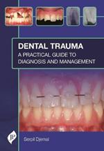 Dental Trauma: A Practical Guide to Diagnosis and Management