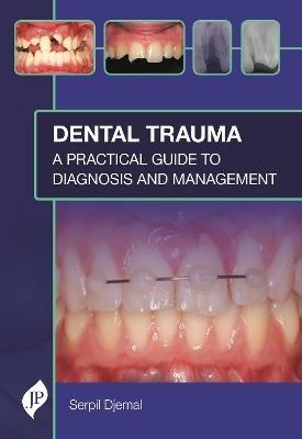 Dental Trauma: A Practical Guide to Diagnosis and Management - Serpil Djemal - cover
