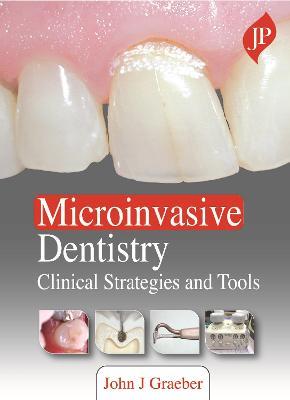 Microinvasive Dentistry: Clinical Strategies and Tools - John J Graeber - cover