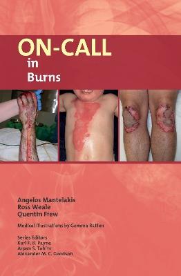 On-Call in Burns - Angelos Mantelakis,Ross Weale,Quentin Frew - cover