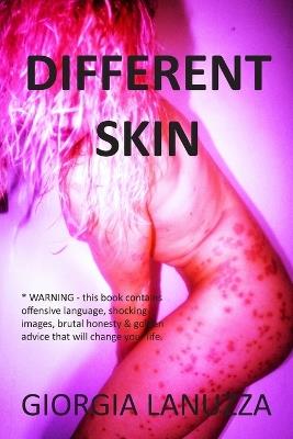 Different Skin - Giorgia Lanuzza - cover