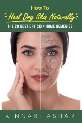 How to Heal Dry Skin Naturally: The 20 Best Dry Skin Home Remedies - Kinnari Ashar - cover