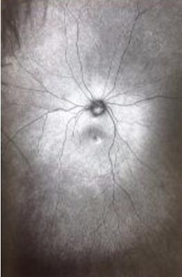 Supplement 3: The Invention and Conclusion of the Eye - Toril Johannessen - cover