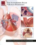 Illustrated Atlas of Human Pathology: A Collection of 25 Anatomical Charts of Human Pathology