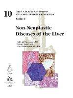 Non-Neoplastic Diseases of the Liver - Michael Torbenson,Sanjay Kakar,Kay Washington - cover