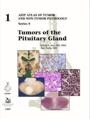 Tumors of the Pituitary Gland - Sylvia L. Asa,Arie Perry - cover