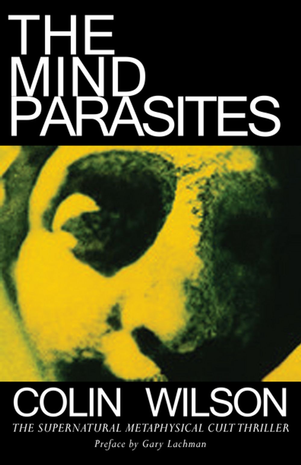 ibs