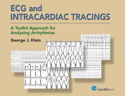 ECG and Intracardiac Tracings: A Toolkit Approach for Analyzing Arrhythmias - George J Klein - cover
