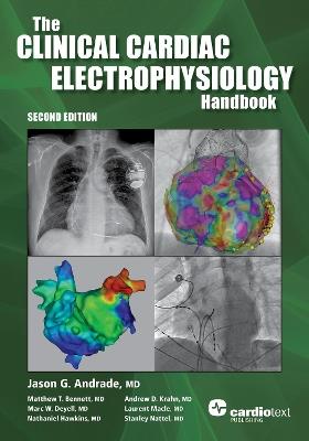The Clinical Cardiac Electrophysiology Handbook, Second Edition - jason G. Andrade,Matthew T. Bennett,Marc W. Deyell - cover