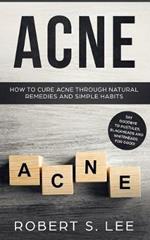 Acne: How to Cure Acne through Natural Remedies and Simple Habits. Say Goodbye to Pustules, Blackheads and Whiteheads for Good!
