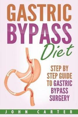 Gastric Bypass Diet: Step By Step Guide to Gastric Bypass Surgery - John Carter - cover