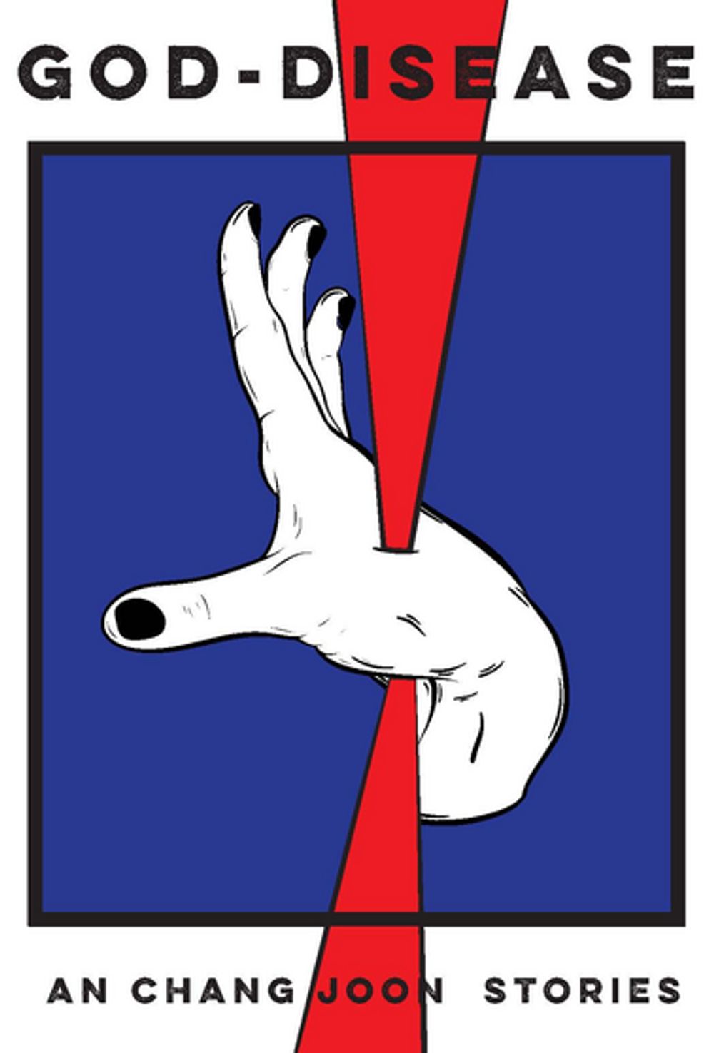ibs