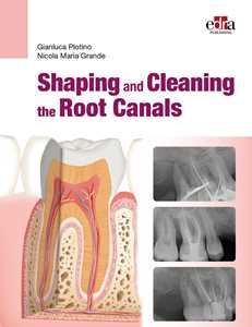 Libro Shaping and Cleaning the Root Canals Gianluca Plotino Nicola Maria Grande