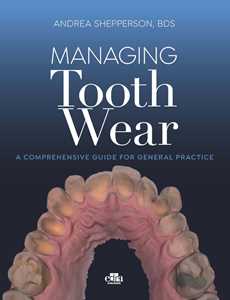 Managing tooth Wear. A comprehensive guide for general practice
