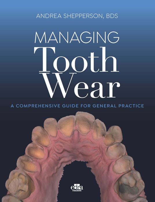 Managing tooth Wear. A comprehensive guide for general practice - Andrea Shepperson - copertina
