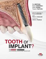 Tooth or Implant?
