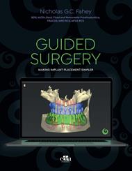 GUIDED SURGERY