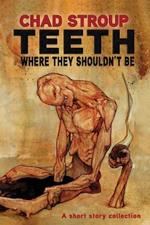 Teeth Where They Should't Be