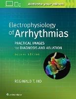 Electrophysiology of Arrhythmias: Practical Images for Diagnosis and Ablation - Reginald T. Ho - cover