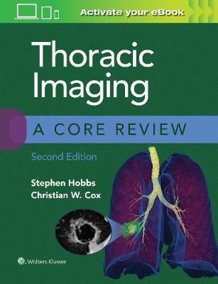 Thoracic Imaging: A Core Review - Stephen Hobbs,Christian Cox - cover