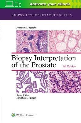 Biopsy Interpretation of the Prostate - Jonathan I. Epstein - cover