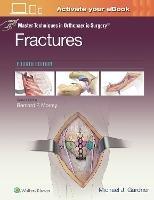 Master Techniques in Orthopaedic Surgery: Fractures - Michael J. Gardner - cover
