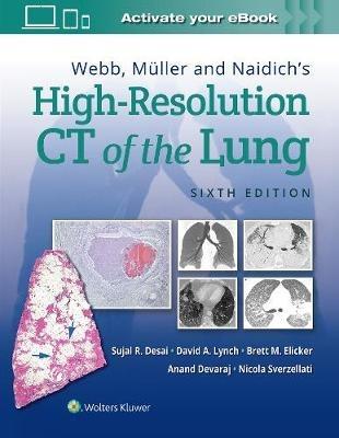 Webb, Müller and Naidich's High-Resolution CT of the Lung - Sujal Desai,David Lynch,Brett M Elicker - cover