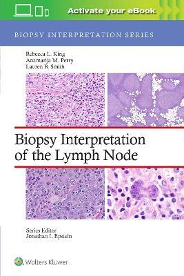 Biopsy Interpretation of the Lymph Node - Rebecca Leigh King,Anamarija M. Perry,Lauren B. Smith - cover