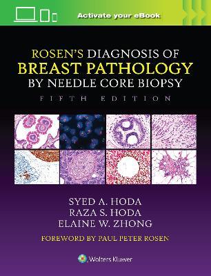 Rosen's Diagnosis of Breast Pathology by Needle Core Biopsy - Syed A. Hoda,Raza S. Hoda,Elaine Zhong - cover