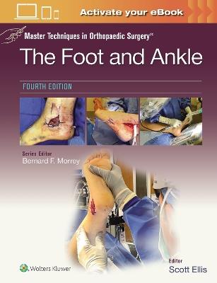 Master Techniques in Orthopaedic Surgery: The Foot and Ankle: Print + eBook with Multimedia - Scott Ellis - cover