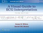 A Visual Guide to ECG Interpretation: Print + eBook with Multimedia
