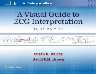 A Visual Guide to ECG Interpretation - Susan Renee Wilcox,DAVID F. M. BROWN - cover