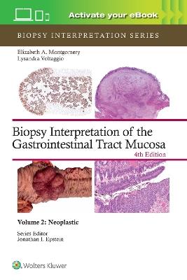 Biopsy Interpretation of the Gastrointestinal Tract Mucosa Volume 2: Neoplastic: Print + eBook with Multimedia - ELIZABETH ANNE MONTGOMERY,LYSANDRA VOLTAGGIO - cover