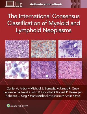 The International Consensus Classification of Myeloid and Lymphoid Neoplasms - DANIEL A. ARBER - cover