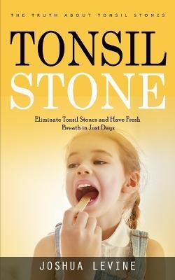 Tonsil Stones: The Truth about Tonsil Stones (Eliminate Tonsil Stones and Have Fresh Breath in Just Days!) - Joshua Levine - cover