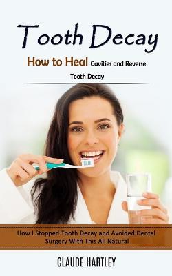 Tooth Decay: How to Heal Cavities and Reverse Tooth Decay (How I Stopped Tooth Decay and Avoided Dental Surgery With This All Natural) - Claude Hartley - cover