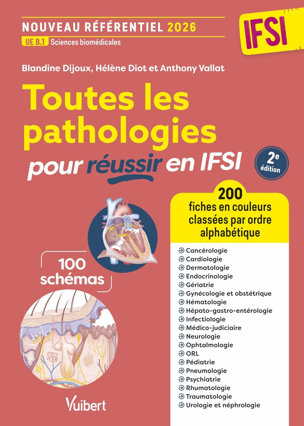 ibs