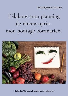 J'élabore mon planning de menus après mon pontage coronarien. - Cédric Menard - cover