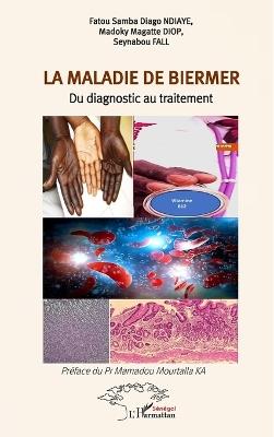 La maladie de Biermer: Du diagnostic au traitement - Fatou Samba Diago Ndiaye,Madoky Magatte Diop,Seynabou Fall - cover