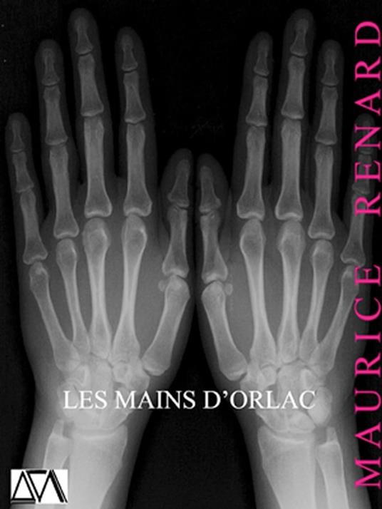 Les Mains d'Orlac - Maurice Renard - ebook