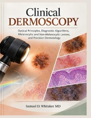Clinical Dermoscopy - Samuel D Whitaker - cover