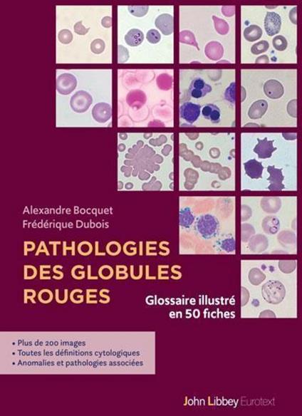 Pathologies des globules rouges