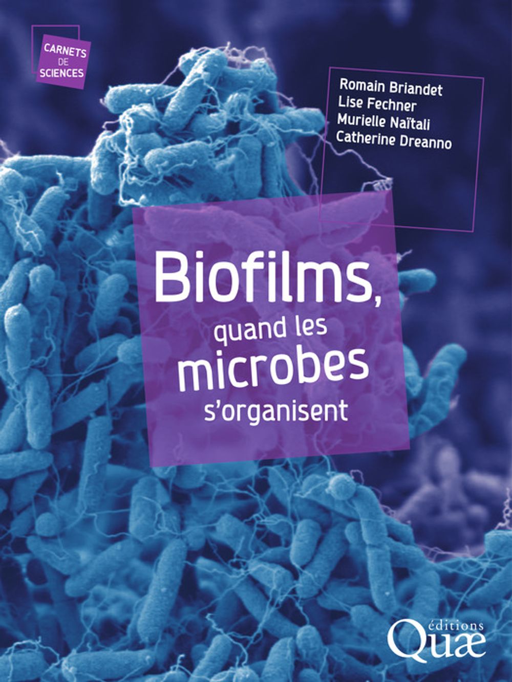 ibs