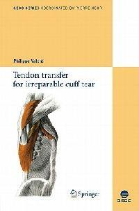 Tendon transfer for irreparable cuff tear - cover