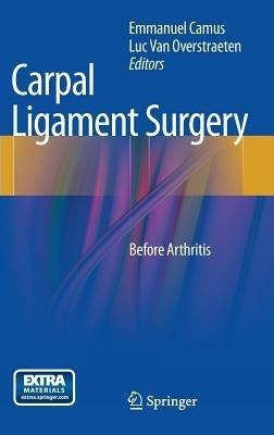 Carpal Ligament Surgery: Before Arthritis - cover