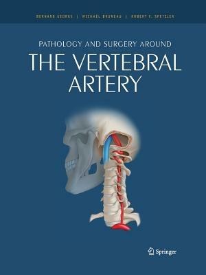 Pathology and surgery around the vertebral artery - cover