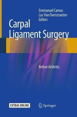 Carpal Ligament Surgery: Before Arthritis - cover