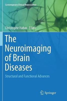 The Neuroimaging of Brain Diseases: Structural and Functional Advances - cover